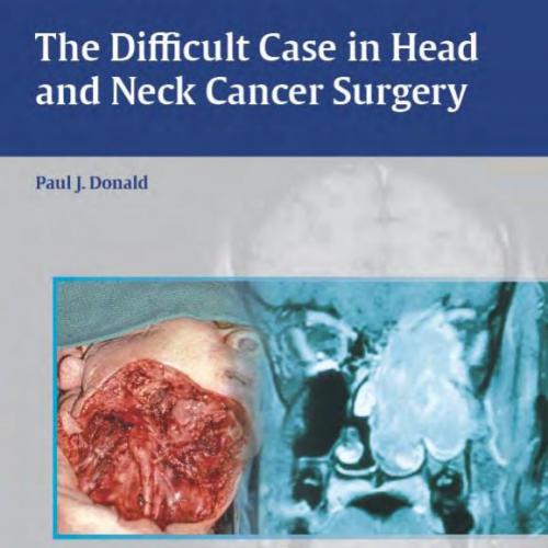 Thieme_ The Difficult Case in Head and Neck Cancer Surgery - Donald, Paul J_