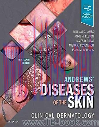 Andrews&rsquo; Diseases of the Skin E-Book: Clinical Dermatology 13th Edition by William D. James
