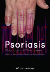 [AME]Psoriasis: Diagnosis and Management