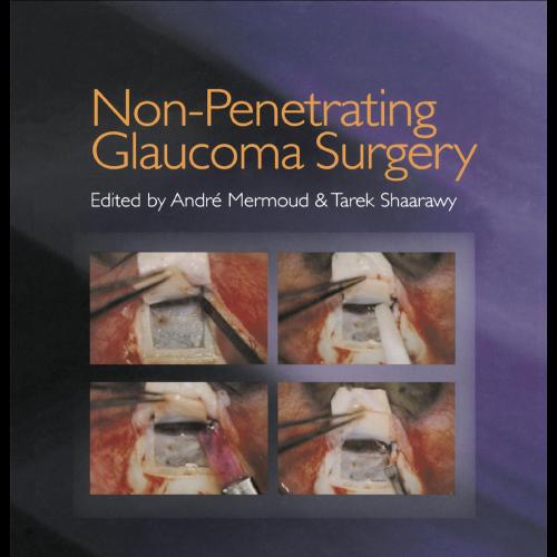 Non-Penetrating Glaucoma Surgery