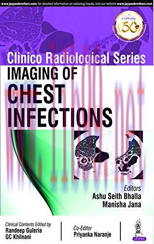 [AME]Imaging of Chest Infections (Clinico Radiological) (Original PDF)