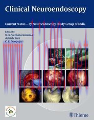[AME]Clinical Neuroendoscopy: Current Status By Neuroendoscopy Group of India (Original PDF)