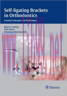 [AME]Self-ligating Brackets in Orthodontics: Current Concepts and Techniques
