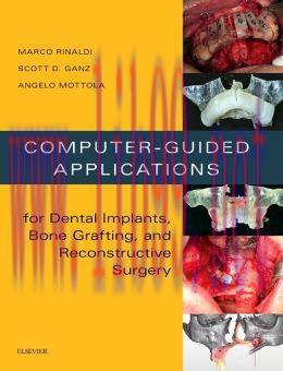 [AME]Computer-Guided Applications for Dental Implants, Bone Grafting, and Reconstructive Surger...