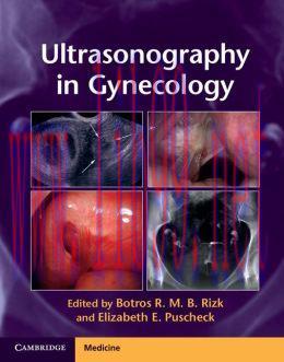 [AME]Ultrasonography in Gynecology