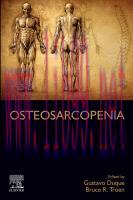 [PDF]Osteosarcopenia