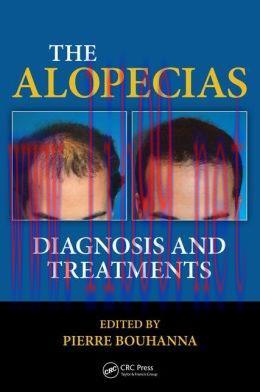 [AME]The Alopecias: Diagnosis and Treatments (Original PDF)