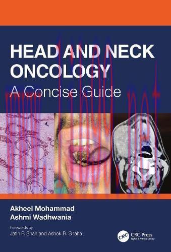 [AME]Head and Neck Oncology: A Concise Guide (Original PDF)
