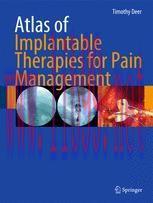 [PDF]Atlas of Implantable Therapies for Pain Management