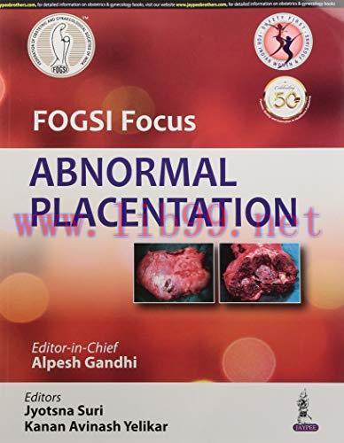[AME]FOGSI Focus Abnormal Placentation (Original PDF)