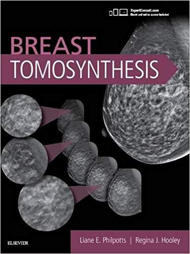 Breast Tomosynthesis, 1e 1st Edition