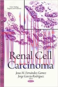 [AME]Renal Cell Carcinoma