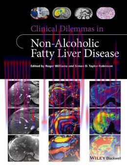[AME]Clinical Dilemmas in Non-Alcoholic Fatty Liver Disease