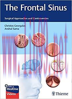 [AME]The Frontal Sinus: Surgical Approaches and Controversies (EPUB)