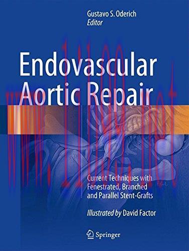[AME]Endovascular Aortic Repair: Current Techniques with Fenestrated, Branched and Parallel Ste...