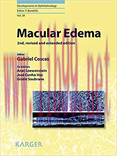 [PDF]Macular Edema