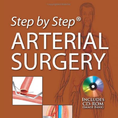 Step by Step Arterial Surgery - Wei Zhi