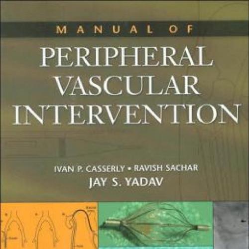 Manual of Peripheral Vascular Intervention - Wei Zhi