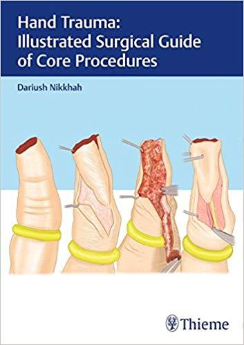 Hand Trauma - Illustrated Surgical Guide of Core Procedures