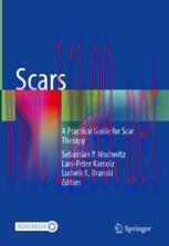 [PDF]Scars: A Practical Guide for Scar Therapy
