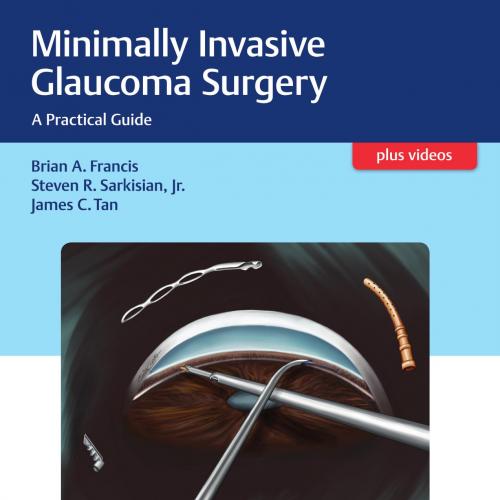 Minimally Invasive Glaucoma Surgery A Practical Guide