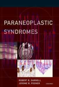 [AME]Paraneoplastic Syndromes (Contemporary Neurology Series)