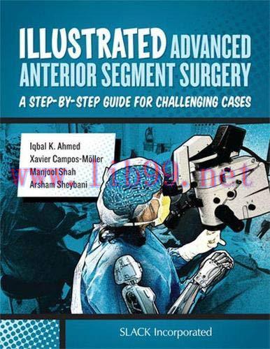 [AME]Illustrated Advanced Anterior Segment Surgery: A Step-by-Step Guide for Challenging Cases ...