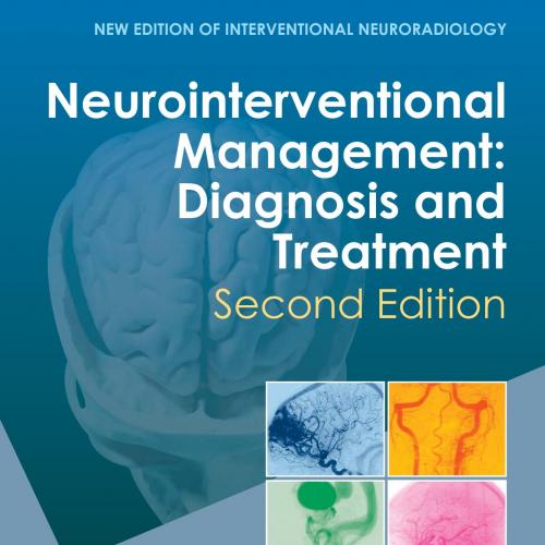 Neurointerventional Management-Diagnosis and Treatment,2nd Edition