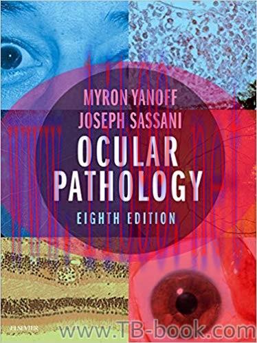 Ocular Pathology 8th Edition by Myron Yanoff