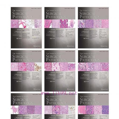 [AME]American Journal of Surgical Pathology 2021 Full Archives (True PDF)