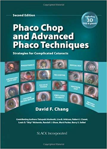 Phaco Chop and Advanced Phaco Techniques, 2nd Edition