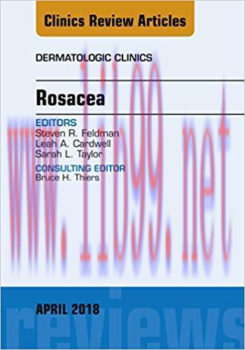 [AME]Rosacea, An Issue of Dermatologic Clinics, E-Book (The Clinics: Dermatology) (PDF)