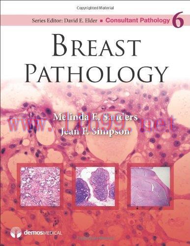 [AME]Breast Pathology (Consultant Pathology), Volume 6