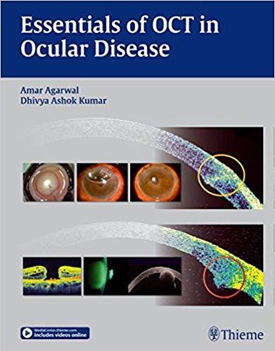 Essentials of OCT in Ocular Disease + Videos