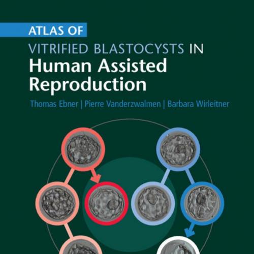 Atlas of Vitrified Blastocysts in Human Assisted Reproduction - THOMAS EBNER, PIERRE VANDERZWAL...