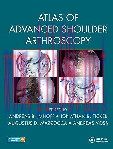 [AME]Atlas of Advanced Shoulder Arthroscopy (EPUB)
