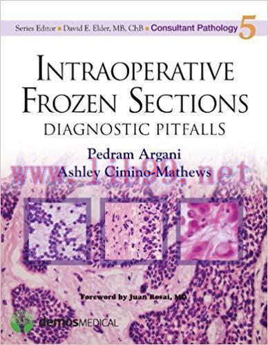 [PDF]Intraoperative Frozen Sections: Diagnostic Pitfalls (Consultant Pathology) 1st Edition