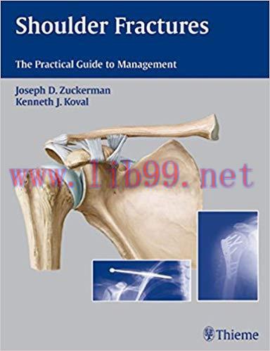 [PDF]Shoulder Fractures - The Practical Guide to Management