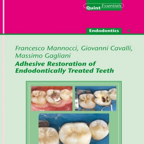 Adhesive Restoration of Endodontically Treated Teeth - Francesco Mannocci _ Giovanni Cavalli _ ...