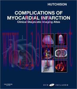 [AME]Complications of Myocardial Infarction: Clinical Diagnostic Imaging Atlas (ORIGINAL PDF fr...