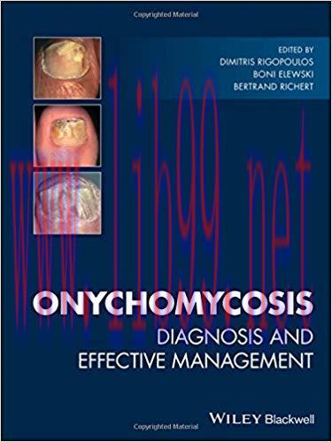 [PDF]Onychomycosis: Diagnosis and Effective Management