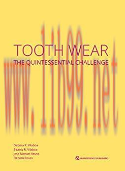 [AME]Tooth Wear: The Quintessential Challenge (ePub+Converted PDF)