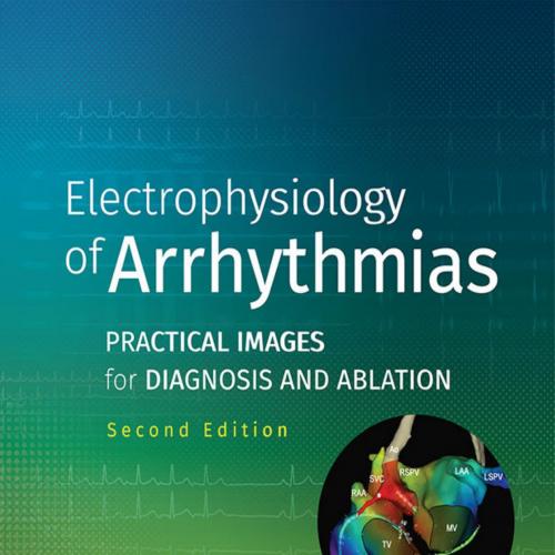 Electrophysiology of Arrhythmias - Reginald T. Ho