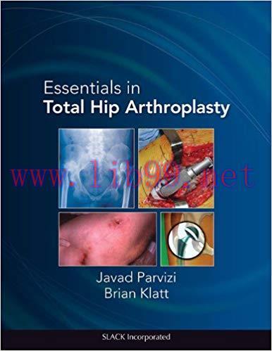 [PDF]Essentials in Total Hip Arthroplasty