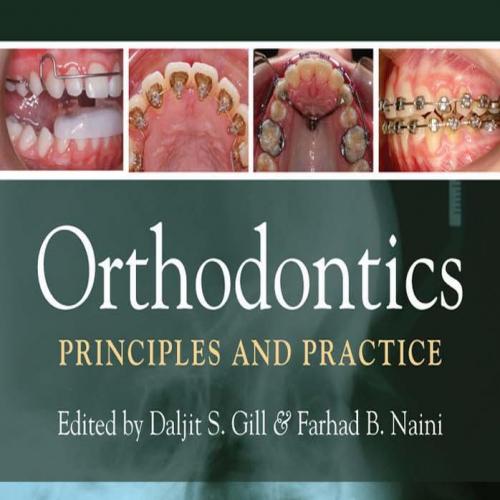 Orthodontics Principles and Practice