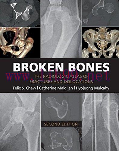 [AME]Broken Bones: The Radiologic Atlas of Fractures and Dislocations