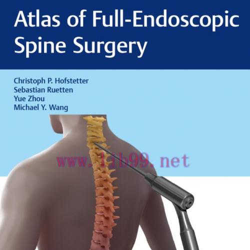 [PDF]Atlas of Full-Endoscopic Spine Surgery