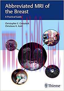 [PDF]Abbreviated MRI of the Breast A Practical Guide