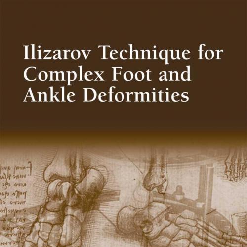Ilizarov Technique for Complex Foot and Ankle Deformities