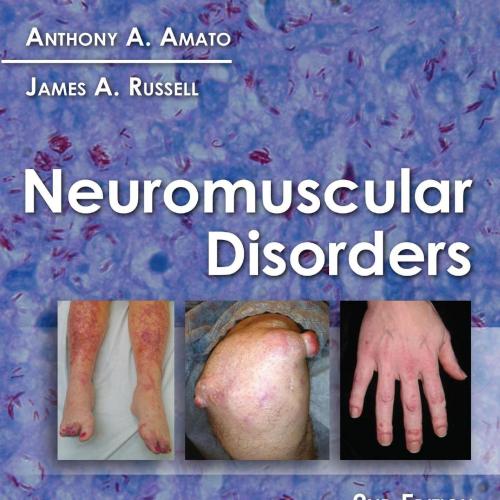 Neuromuscular Disorders 2nd Edition